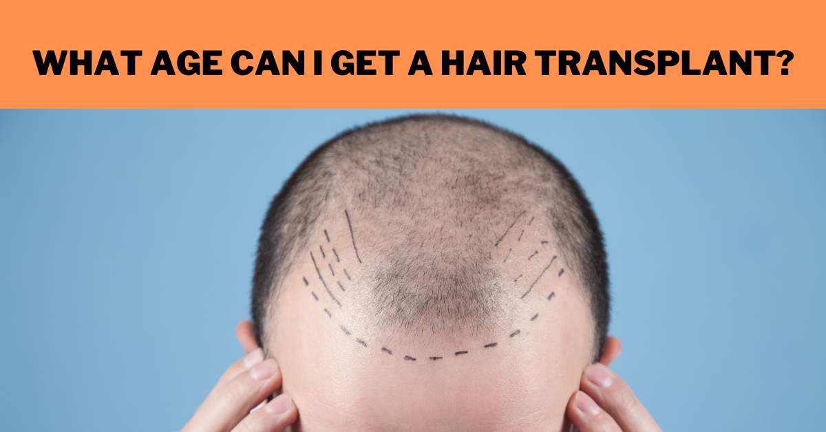 What Age Can I Get a Hair Transplant?